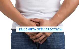 Причины, симптомы и лечение отёка простаты