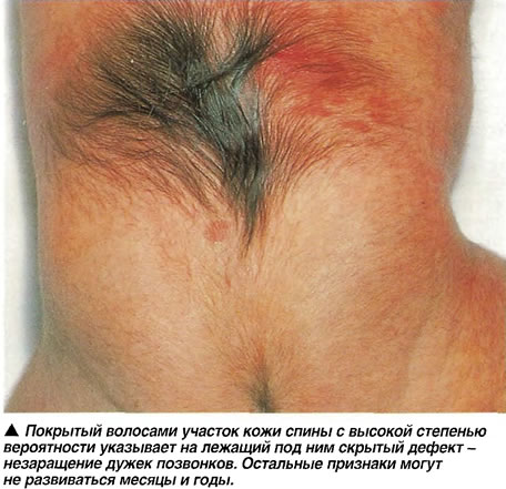 спина